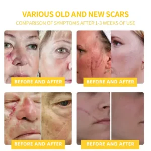 Made and Shipped from USA✨ LOVILDS™ Bee Toxin Skin Repair Cream🔥 Last day 80% OFF💎💎