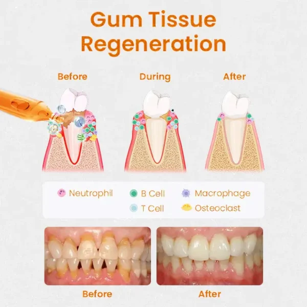 [Official Brand Store] LOVILDS™ Gum Repair Treatment Ampoules