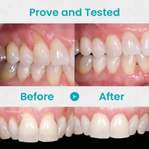 [Official Brand Store] LOVILDS™ Gum Repair Treatment Ampoules