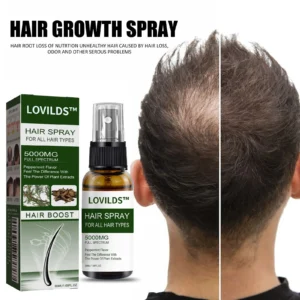 Say Goodbye to Hair Loss — Regrow Thicker, Fuller Hair with LOVILDS™ 🌿