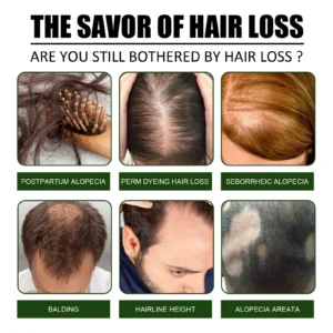 Say Goodbye to Hair Loss — Regrow Thicker, Fuller Hair with LOVILDS™ 🌿