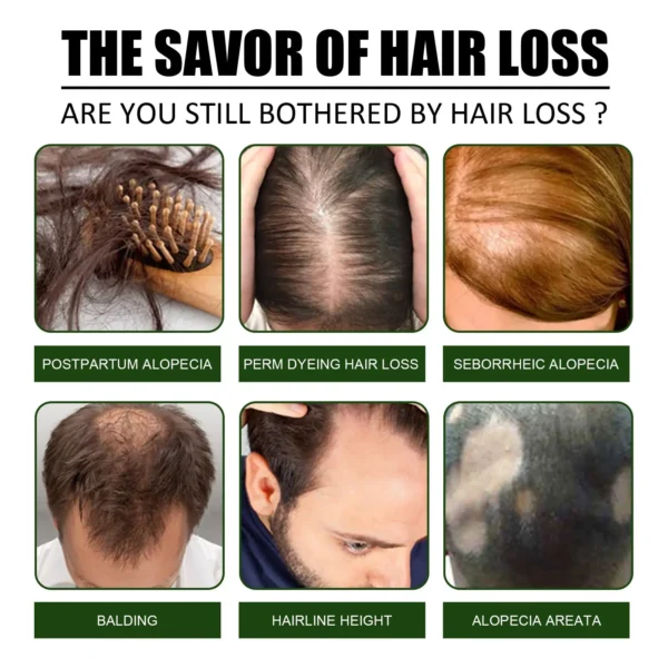 Say Goodbye to Hair Loss — Regrow Thicker, Fuller Hair with LOVILDS™ 🌿