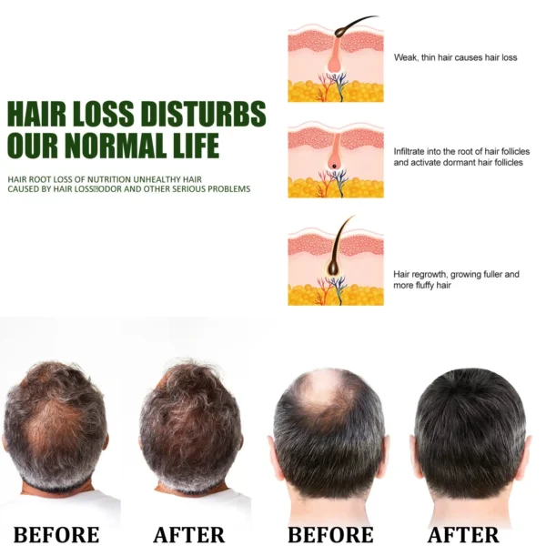 Say Goodbye to Hair Loss — Regrow Thicker, Fuller Hair with LOVILDS™ 🌿