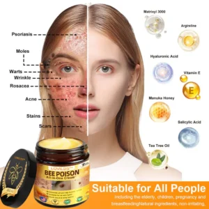 [𝐎𝐟𝐟𝐢𝐜𝐢𝐚𝐥 𝐁𝐫𝐚𝐧𝐝 𝐒𝐭𝐨𝐫𝐞] 🐝 LOVILDS™ 𝐁𝐞𝐞 𝐕𝐞𝐧𝐨𝐦 𝐀𝐥𝐥-𝐢𝐧-𝐎𝐧𝐞 𝐂𝐫𝐞𝐚𝐦 (👩‍⚕️ 𝐀𝐦𝐞𝐫𝐢𝐜𝐚𝐧 𝐀𝐜𝐚𝐝𝐞𝐦𝐲 𝐨𝐟 𝐃𝐞𝐫𝐦𝐚𝐭𝐨𝐥𝐨𝐠𝐲 𝟐𝟎𝟐𝟓 𝐒𝐩𝐞𝐜𝐢𝐚𝐥𝐥𝐲 𝐑𝐞𝐜𝐨𝐦𝐦𝐞𝐧𝐝𝐞𝐝 𝐏𝐫𝐨𝐝𝐮𝐜𝐭)