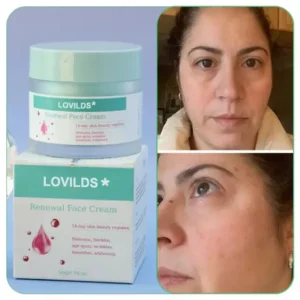 Final Hours—Sale Ending Soon!💥LOVILDS* Renewal Skin Cream | Spot Removal & Skin Renewal for Dark Spots, Age Spots, and Sun Spots* Daily Firming for All Skin Types