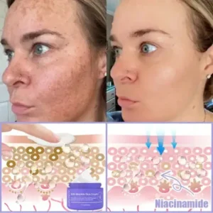 🎁LOVILDS® Bee Venom Multi-Action Face Cream, certified by American dermatologists (👩‍⚕️FDA recommended)💥