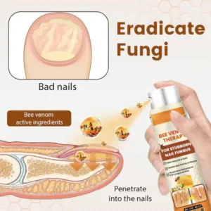 LOVILDS™ Bee Venom Nail Fungus Spray