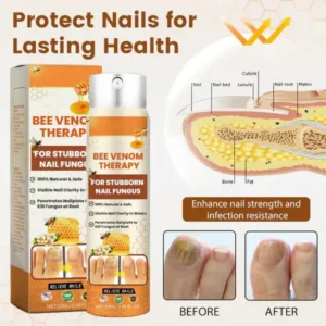 LOVILDS™ Bee Venom Nail Fungus Spray