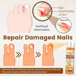 LOVILDS™ Bee Venom Nail Fungus Spray