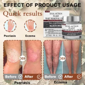 LOVILDS® Black Rice Skin Repair Essence Cream 👨‍⚕️ MHRA Certified (Removes warts and skin growths, improves keratin buildup and seborrheic dermatitis, follicular keratosis, skin cancer, and age spots)