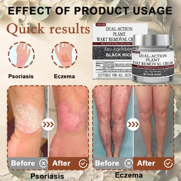 LOVILDS® Black Rice Skin Repair Essence Cream 👨‍⚕️ MHRA Certified (Removes warts and skin growths, improves keratin buildup and seborrheic dermatitis, follicular keratosis, skin cancer, and age spots)