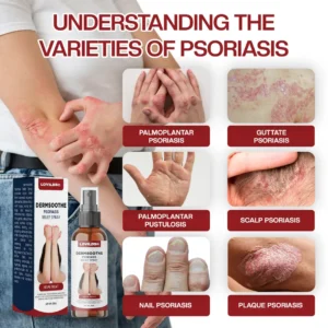 LOVILDS® DermSoothe Psoriasis Relief Spray