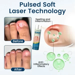 LOVILDS®  Fungal Repair Herbal Spray