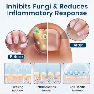 LOVILDS®  Fungal Repair Herbal Spray