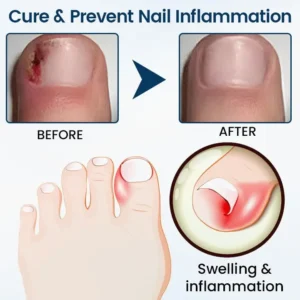 LOVILDS®  Fungal Repair Herbal Spray