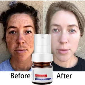 LOVILDS™  WHITENING ANDFRECKLE REMOVING ESSENCE
