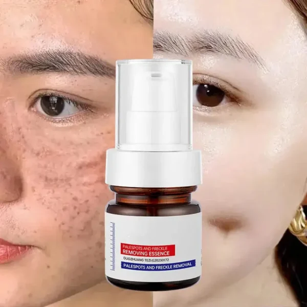 LOVILDS™  WHITENING ANDFRECKLE REMOVING ESSENCE