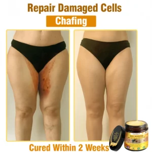 [Official Brand Store] 🏆Lovilds™ BEE POISON All-in-One Cream (✅FDA Approved & Mayo Clinic Recommended)