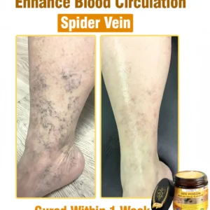 [Official Brand Store] 🏆Lovilds™ BEE POISON All-in-One Cream (✅FDA Approved & Mayo Clinic Recommended)