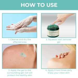 🔥（Official retail store） LOVILDS™ NatureErase Instant Mole & Spot Removal Gel