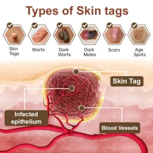 Still letting these skin issues mess with you on repeat? 👋 👨‍⚕️ TGA-Certified LOVILDS® Black Rice Skin Repair Essence Cream: One cream, multiple benefits—rescue your troubled skin!