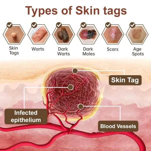 Still letting these skin issues mess with you on repeat? 👋 👨‍⚕️ TGA-Certified LOVILDS® Black Rice Skin Repair Essence Cream: One cream, multiple benefits—rescue your troubled skin!
