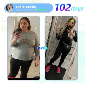 【2025 Medical Grade Newly Upgraded🥇】🇺🇸🇺🇸LOVILDS™ NIDDK-Tirzepatide Nano Microneedle Patch （Zero Pain, 24/7 Release | Lose 20lbs FAST | 90% Sugar Drop | ）