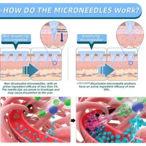 【2025 Medical Grade Newly Upgraded🥇】🇺🇸🇺🇸LOVILDS™ NIDDK-Tirzepatide Nano Microneedle Patch （Zero Pain, 24/7 Release | Lose 20lbs FAST | 90% Sugar Drop | ）