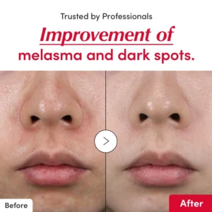 [Amazon No.1] LOVILDS ™Vitamin illuminating Serum