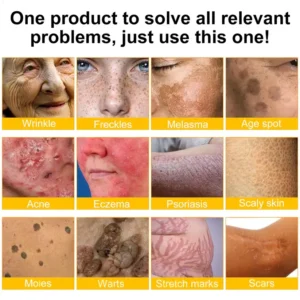 ✨FDA Approved:LOVILDS™ Bee Poison Skin Restoration Cream — 🔥Limited Time 70% OFF🔥