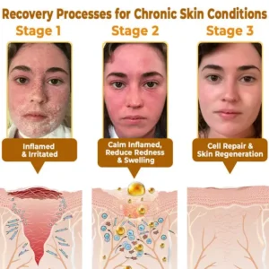 ✨FDA Approved:LOVILDS™ Bee Poison Skin Restoration Cream — 🔥Limited Time 70% OFF🔥