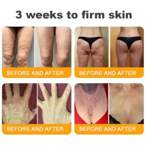 ✨FDA Approved:LOVILDS™  Bee Venom Skin Restoration Cream — 🔥Limited Time 70% OFF🔥