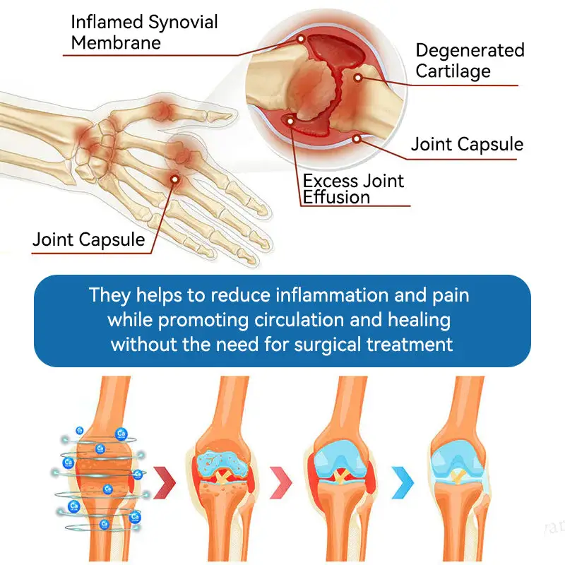 LOVILDSยฎ ๐๐๐-๐๐๐ ๐๐จ๐ข๐ง๐ญ ๐๐๐๐ฅ๐ข๐ง๐ ๐๐ซ๐๐๐ฆ ๐๐ซ๐๐๐ญ๐ฌ ๐๐ซ๐ญ๐ก๐ซ๐ข๐ญ๐ข๐ฌ, ๐๐๐ฎ๐ซ๐จ๐ฉ๐๐ญ๐ก๐ฒ, ๐๐ก๐๐ฎ๐ฆ๐๐ญ๐ข๐ฌ๐ฆ, ๐๐ฉ๐จ๐ซ๐ญ๐ฌ ๐๐ง๐ฃ๐ฎ๐ซ๐ข๐๐ฌ & ๐๐จ๐ซ๐