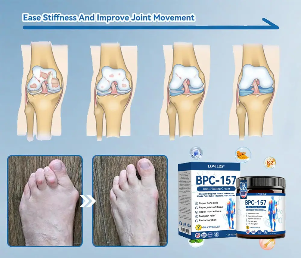 LOVILDSยฎ ๐๐๐-๐๐๐ ๐๐จ๐ข๐ง๐ญ ๐๐๐๐ฅ๐ข๐ง๐ ๐๐ซ๐๐๐ฆ ๐๐ซ๐๐๐ญ๐ฌ ๐๐ซ๐ญ๐ก๐ซ๐ข๐ญ๐ข๐ฌ, ๐๐๐ฎ๐ซ๐จ๐ฉ๐๐ญ๐ก๐ฒ, ๐๐ก๐๐ฎ๐ฆ๐๐ญ๐ข๐ฌ๐ฆ, ๐๐ฉ๐จ๐ซ๐ญ๐ฌ ๐๐ง๐ฃ๐ฎ๐ซ๐ข๐๐ฌ & ๐๐จ๐ซ๐