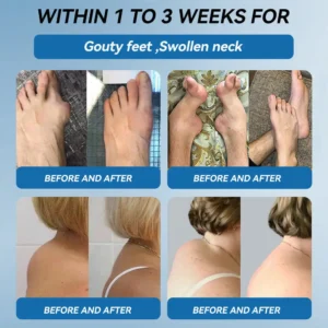 LOVILDSยฎ ๐๐๐-๐๐๐ ๐๐จ๐ข๐ง๐ญ ๐๐๐๐ฅ๐ข๐ง๐ ๐๐ซ๐๐๐ฆ ๐๐ซ๐๐๐ญ๐ฌ ๐๐ซ๐ญ๐ก๐ซ๐ข๐ญ๐ข๐ฌ, ๐๐๐ฎ๐ซ๐จ๐ฉ๐๐ญ๐ก๐ฒ, ๐๐ก๐๐ฎ๐ฆ๐๐ญ๐ข๐ฌ๐ฆ, ๐๐ฉ๐จ๐ซ๐ญ๐ฌ ๐๐ง๐ฃ๐ฎ๐ซ๐ข๐๐ฌ & ๐๐จ๐ซ๐