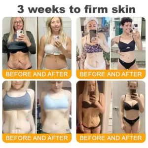 LOVILDS™ 𝘽𝙀𝙀 𝙑𝙀𝙉𝙊𝙈 𝑺𝒌𝒊𝒏 𝑹𝒆𝒔𝒕𝒐𝒓𝒂𝒕𝒊𝒐𝒏 𝑪𝒓𝒆𝒂𝒎 –🌸 Anti-aging,Hydrating, Skin Repair, Even Tone, Acne and Dark Spot Treatment, Wart and Mole Removal, Psoriasis Relief