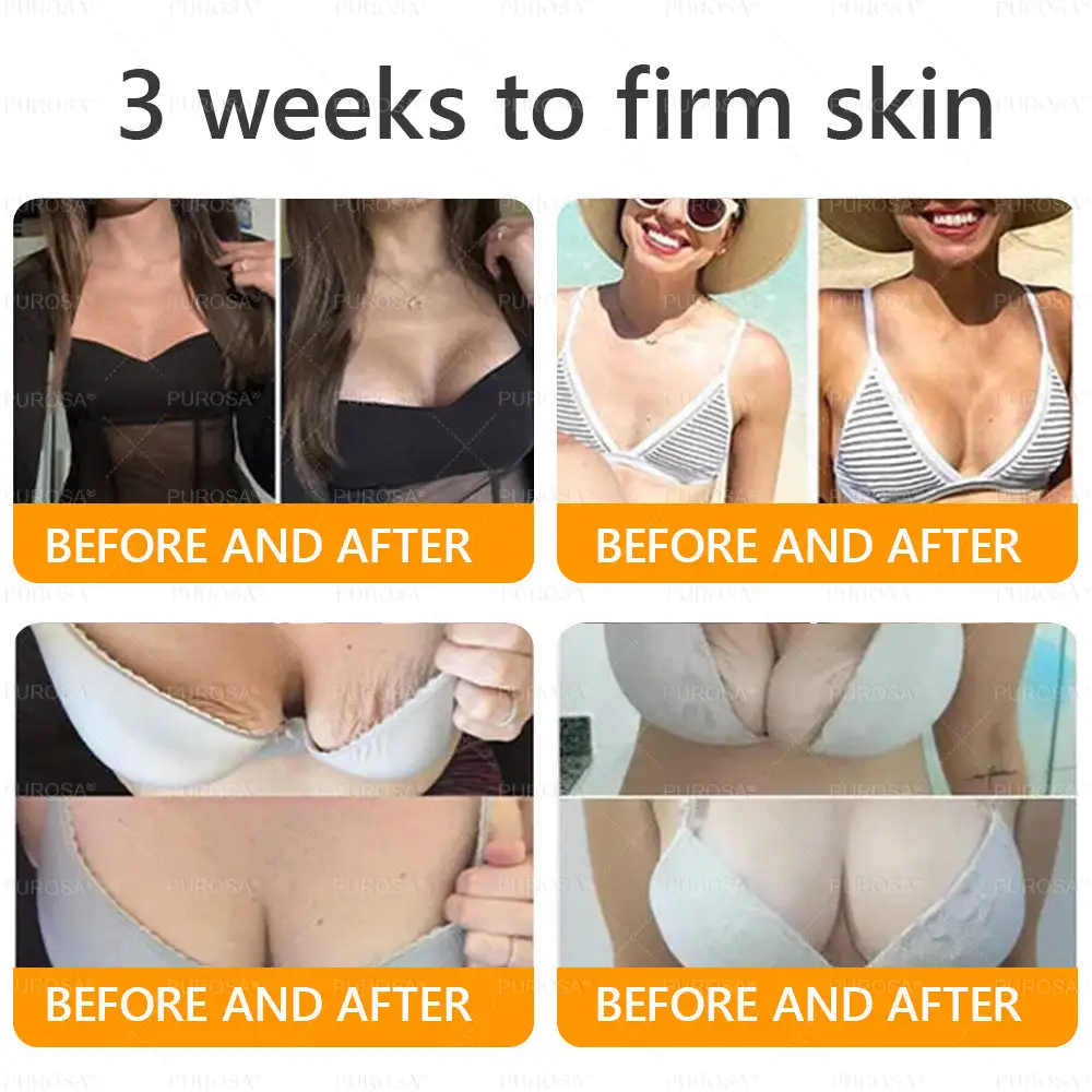 LOVILDS™ 𝘽𝙀𝙀 𝙑𝙀𝙉𝙊𝙈 𝑺𝒌𝒊𝒏 𝑹𝒆𝒔𝒕𝒐𝒓𝒂𝒕𝒊𝒐𝒏 𝑪𝒓𝒆𝒂𝒎 –🌸 Anti-aging,Hydrating, Skin Repair, Even Tone, Acne and Dark Spot Treatment, Wart and Mole Removal, Psoriasis Relief