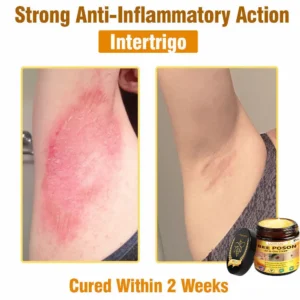 LOVILDS™ BEE POSON All-in-One Cream US Dermatologist Approved