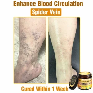 LOVILDS™ BEE POSON All-in-One Cream US Dermatologist Approved