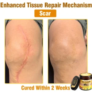 LOVILDS™ Bee Poison All-in-One Cream US Dermatologist Approved