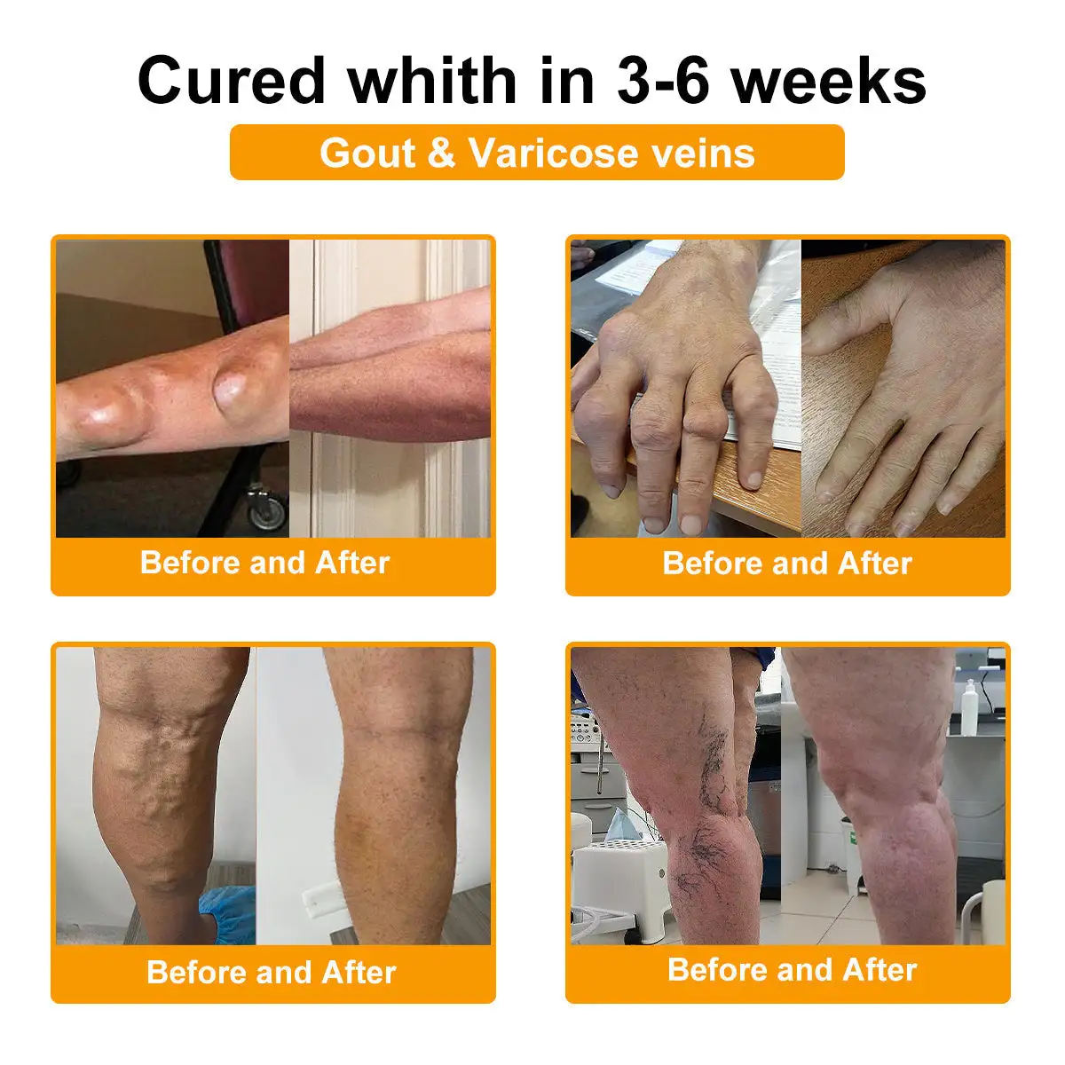 LOVILDS™ Botulinum Toxin & Bee Poison Pain-Relief Bone Healing Cream