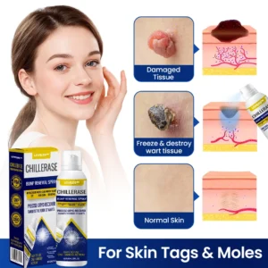 LOVILDS™  ChillErase Bump Renewal Spray