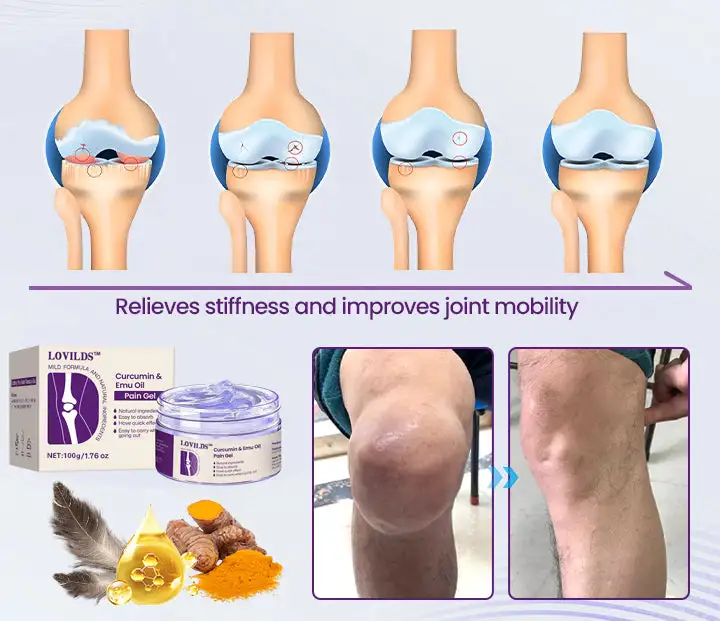 LOVILDS™ Curcumin & Emu Oil Pain Gel – 🌿 Expert-Approved Relief for Joint Pain & Mobility, Backed by US Osteopathic Specialists