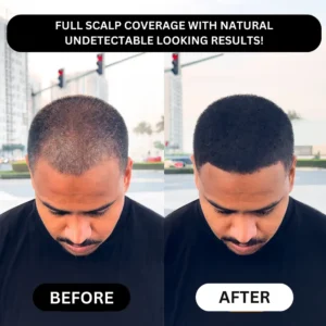 LOVILDS™ - Densify