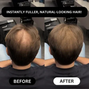 LOVILDS™ - Densify