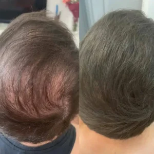 LOVILDS™ - Densify