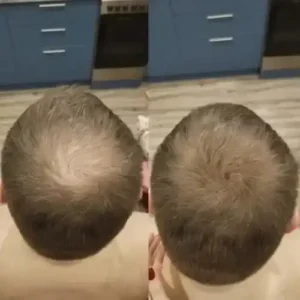 LOVILDS™ - Densify