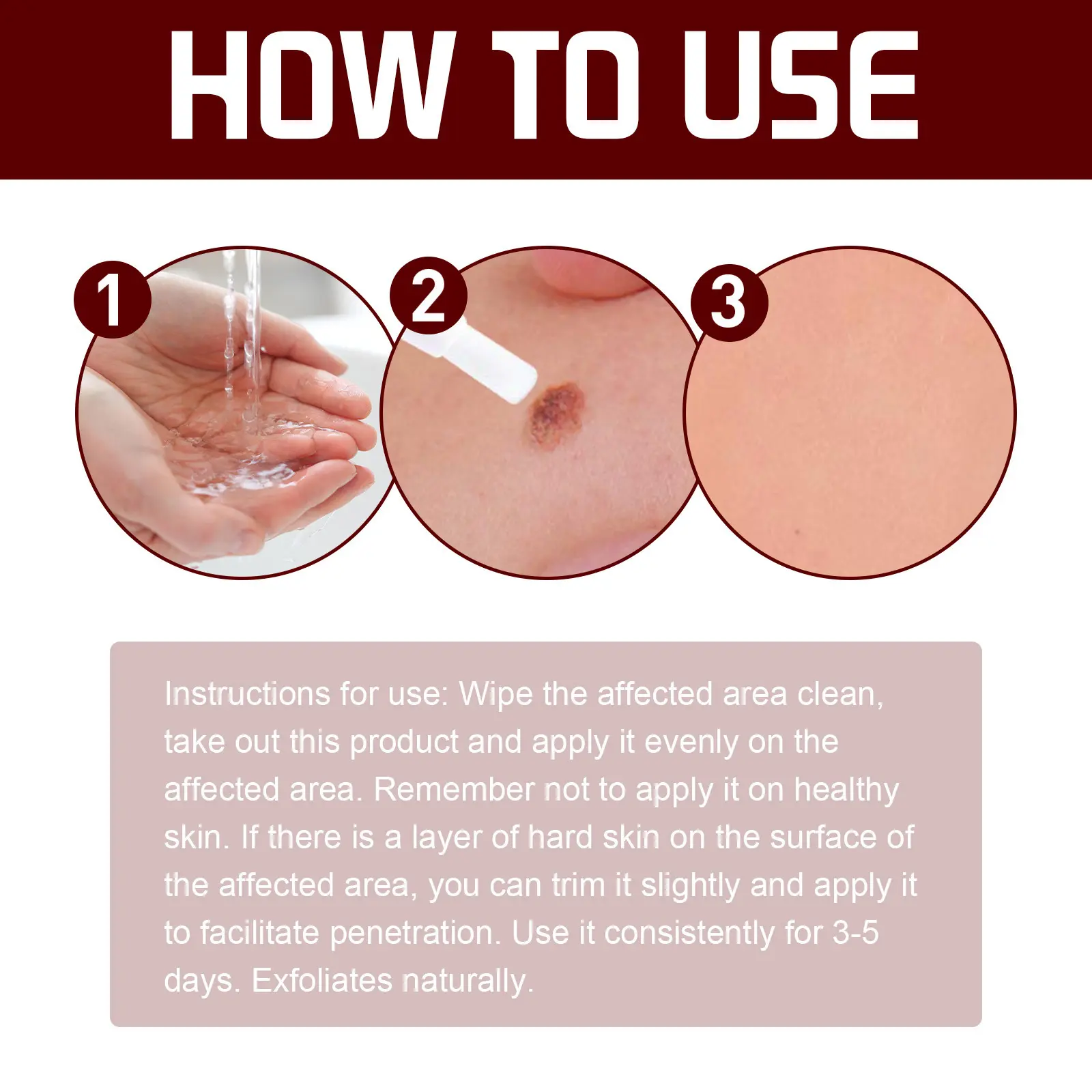 LOVILDS™ LIQUID WART FLAT This mole and wart removal cream gently cleanses, repairs, and softens the skin on your hands, feet, face, and neck.