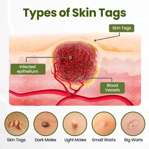 LOVILDS® MagneErase Renewal Cream