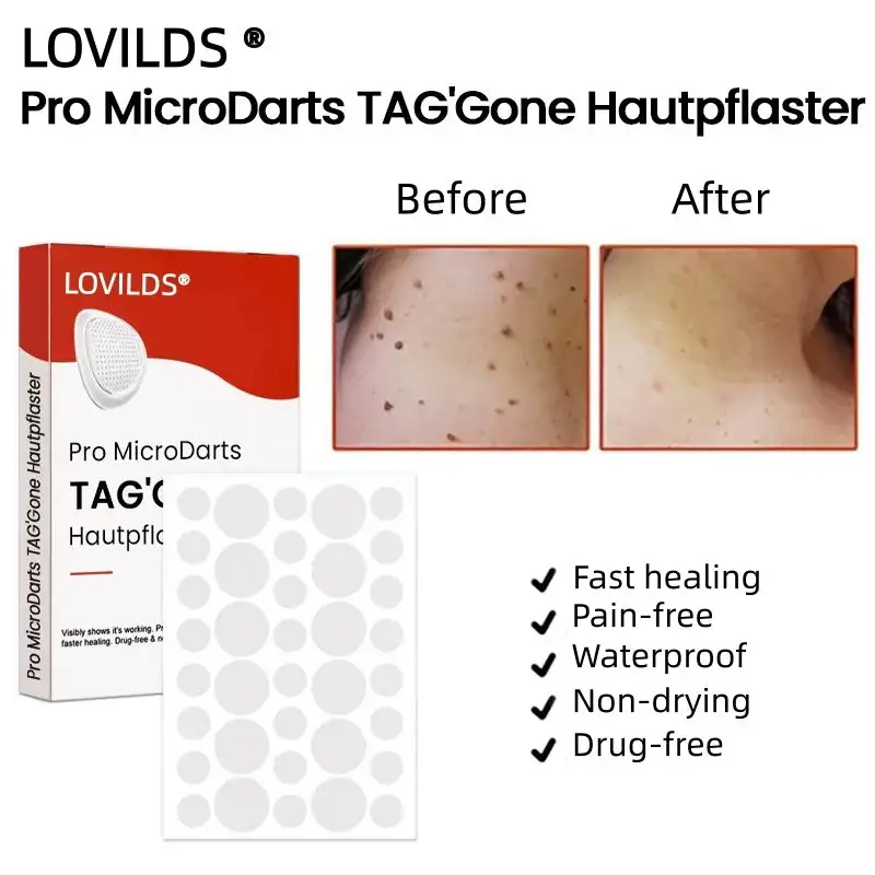 LOVILDS® Pro MicroDarts TAG'Gone Skin Tag Removal Patch